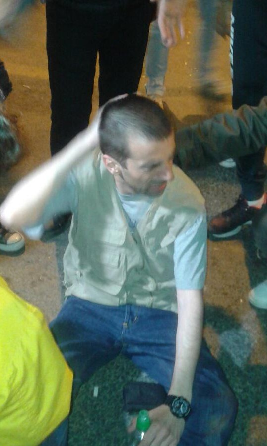 Новинарот на Плусинфо Горан Наумовски беше еден од повредните во полициската акција против протестот на Шарената револуција на 13 април (Фото: Аматерска фотографија)