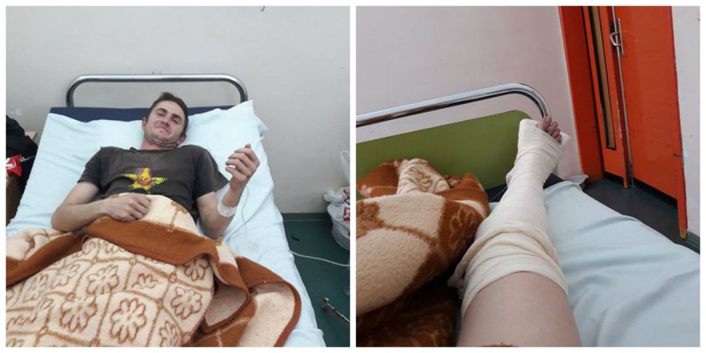 Раде Јанев, кој сега е на Клиниката за трауматологија во Скопје, вели дека поради сериозноста на повредата ќе биде и опериран (Фото: СДК.МК)