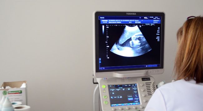 ТРУДНИЦА ИЗБРКАНА ОД РАБОТА ВО 33. НЕДЕЛА ОД БРЕМЕНОСТА ОТКАКО ГАЗДИТЕ ОТВОРИЛЕ НОВА ФИРМА, ГИ ПРЕФРЛИЛЕ СИТЕ ВРАБОТЕНИ И САМО НЕА ЈА ОСТАВИЛЕ ВО ЗГАСНАТАТА