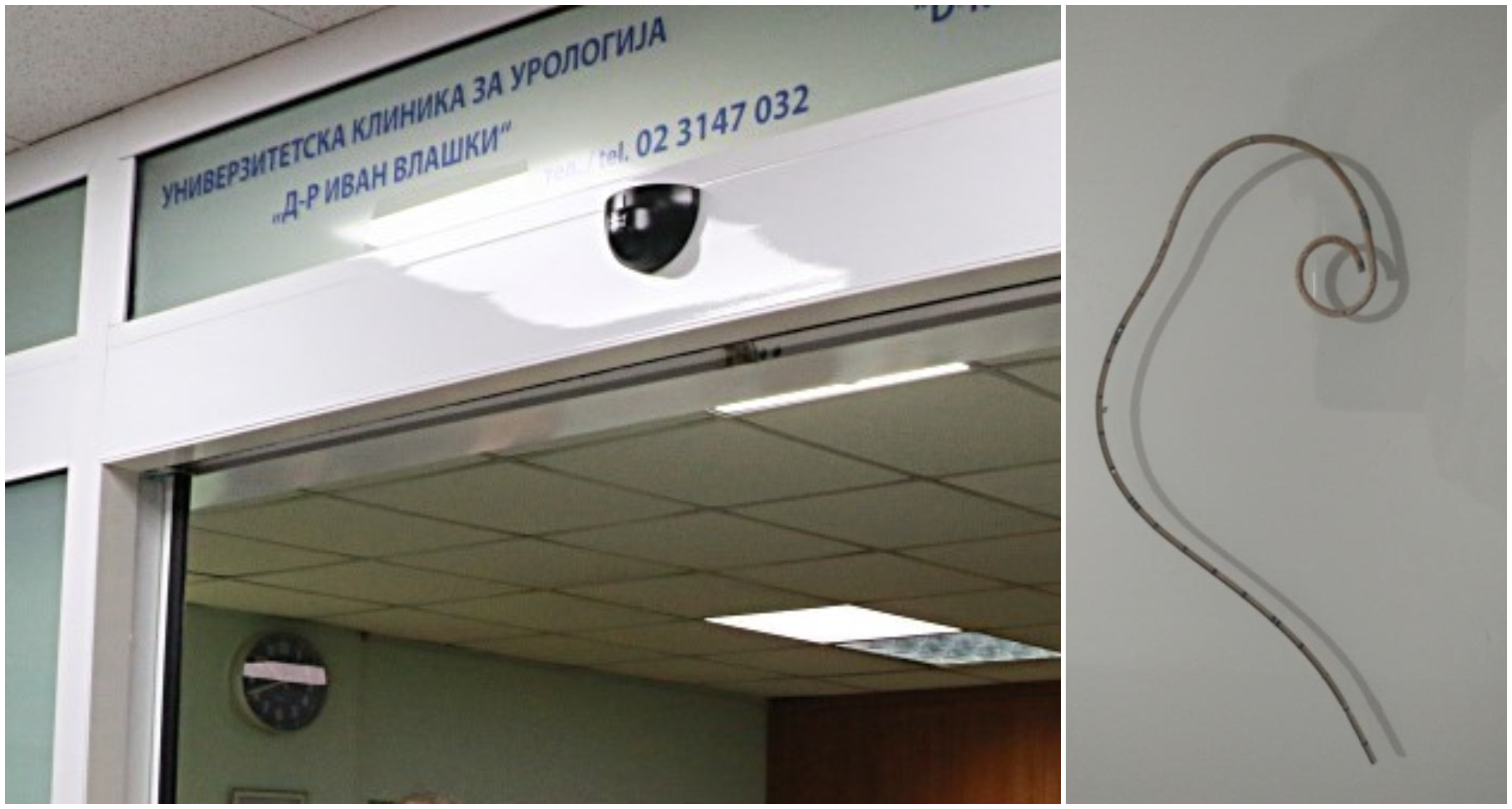 НА КУМАНОВКА Ѝ ЗАБОРАВИЛЕ СОНДА ПРИ ОПЕРАЦИЈА НА БУБРЕГ НА КЛИНИКАТА ЗА УРОЛОГИЈА, СУДОТ ВЕЛИ НЕМА ЛЕКАРСКА ГРЕШКА