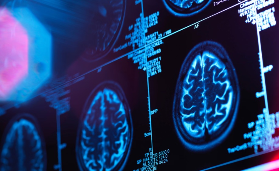 ЧОВЕЧКИОТ МОЗОК МИНУВА НИЗ ПЕТ ЕРИ, А ВОЗРАСНАТА ФАЗА ПОЧНУВА ВО РАНИ 30-ТИ ГОДИНИ, ПОКАЖА НОВО ИСТРАЖУВАЊЕ